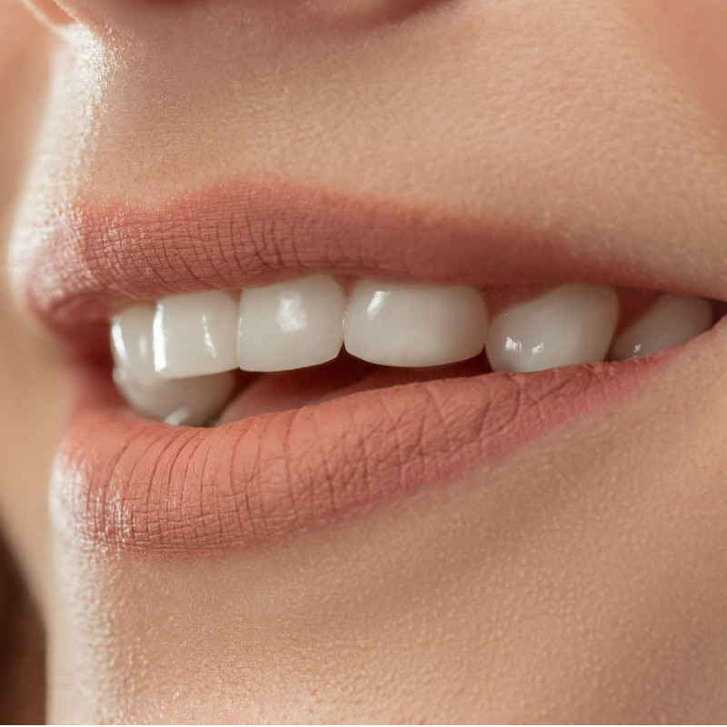 porque-fazer-facetas-de-porcelana